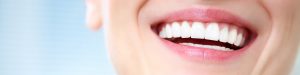 Perfect Smile Makeover in Altrincham