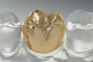 Dental crown made out of gold