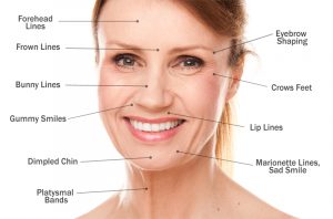 Anti wrinkle treatments 