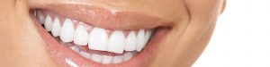 teeth whitening in stockport