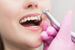woman getting a teeth whitening dental procedure