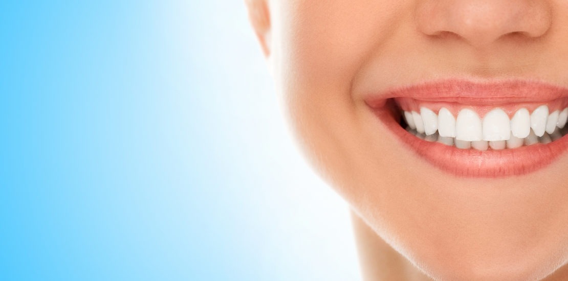 teeth whitening