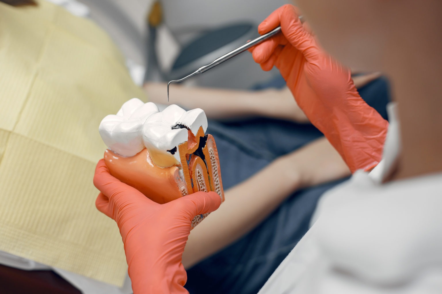 Captivating How Long After Root Canal Can I Eat View Collection Captivating How Long After Root Canal Can I Eat View Collection