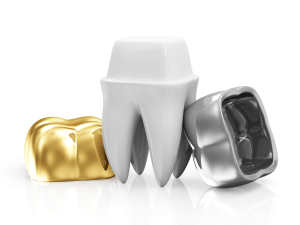 Dental crowns clinic cheadle