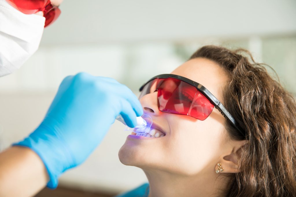 Teeth whitening before summer holidays